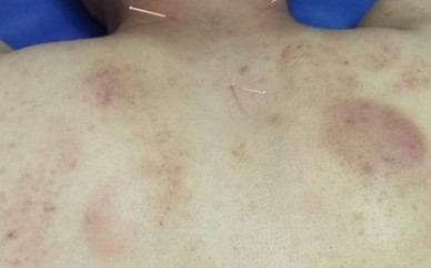 長沙 現在康復理療師證應該怎么去考